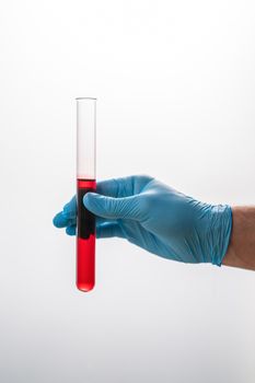 cach-chuan-bi-truoc-khi-di-xet-nghiem-de-ket-qua-chinh-xac-nhat