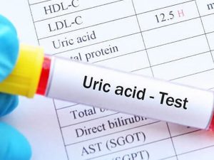 acid-uric-mau-02