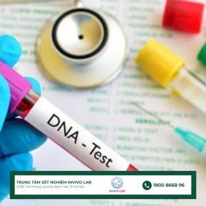 dna-test