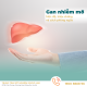 gan-nhiem-mo-do-123