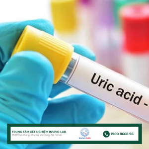 chi-so-acid-uric