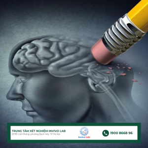 alzheimer-la-gi
