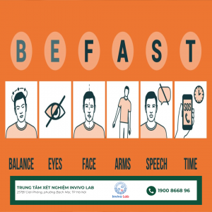 quy-tac-be-fast