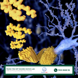 mang-amyloid