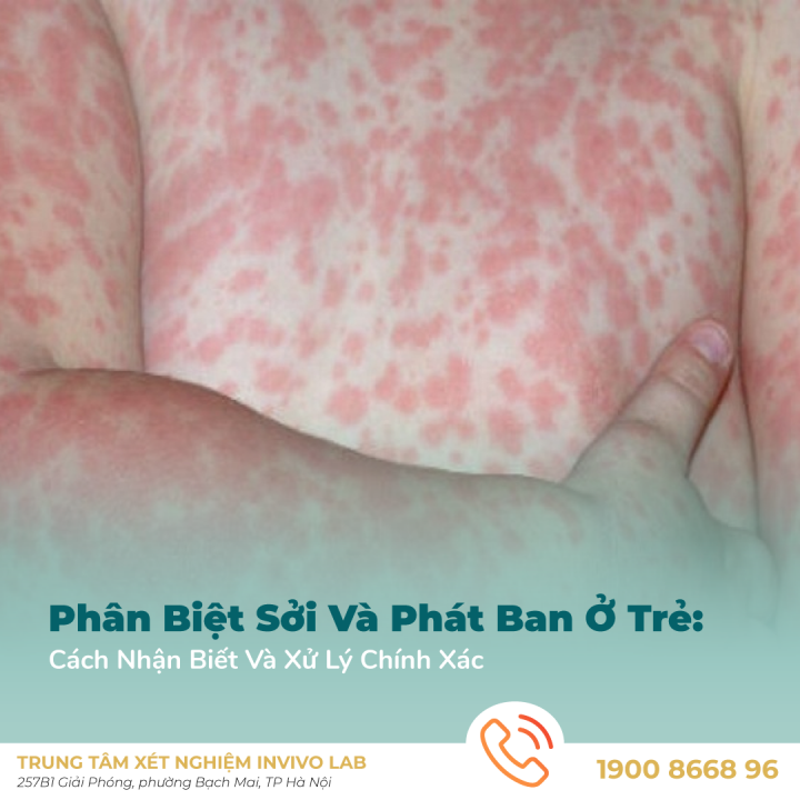 phan-biet-soi-va-phat-ban-o-tre-cach-nhan-biet-va-xu-ly