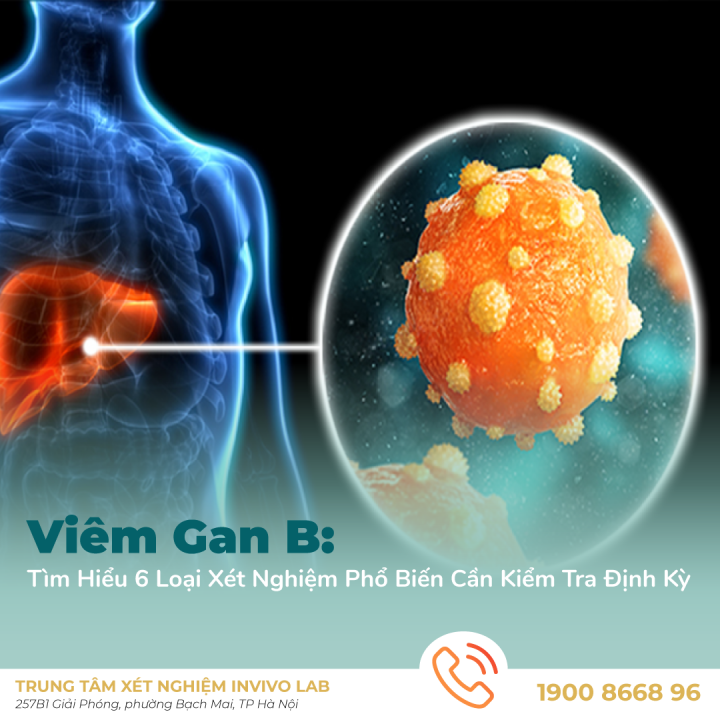 viem-gan-b-6-loai-xet-nghiem-pho-bien-can-kiem-tra-dinh-ky