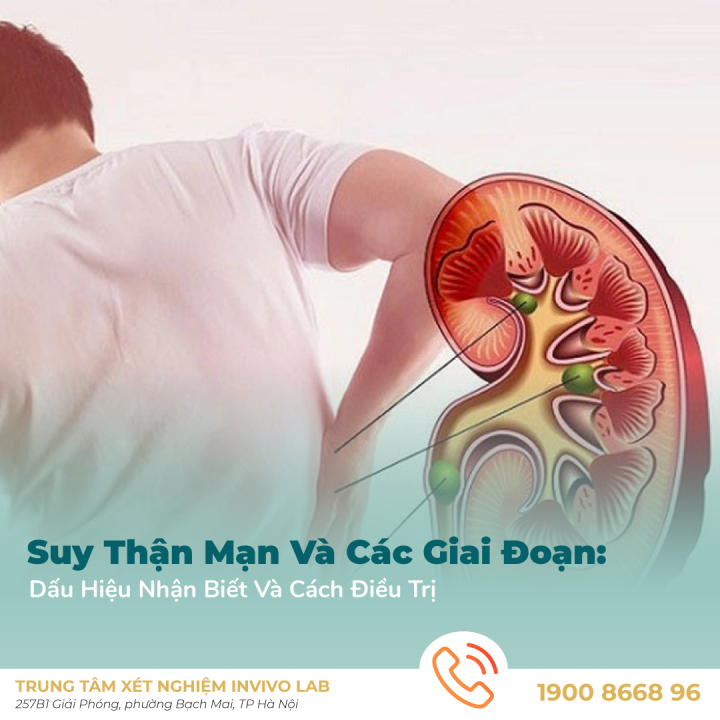 suy-than-man-va-cac-giai-doan-dau-hieu-nhan-biet-va-cach-dieu-tri