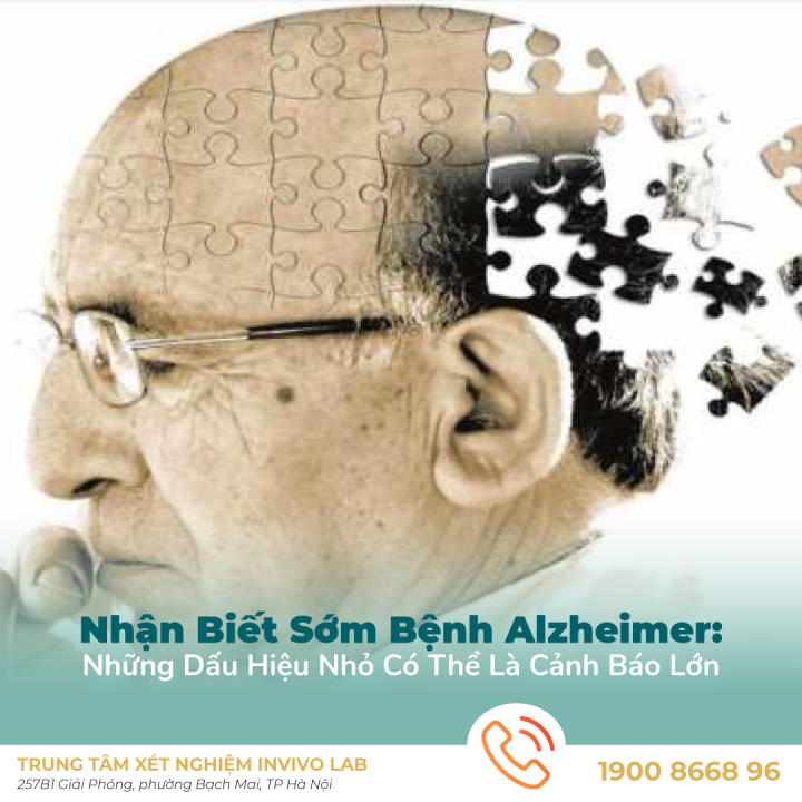 benh-alzheimer-nhan-dien-som-tu-nhung-dau-hieu-nho-nhat