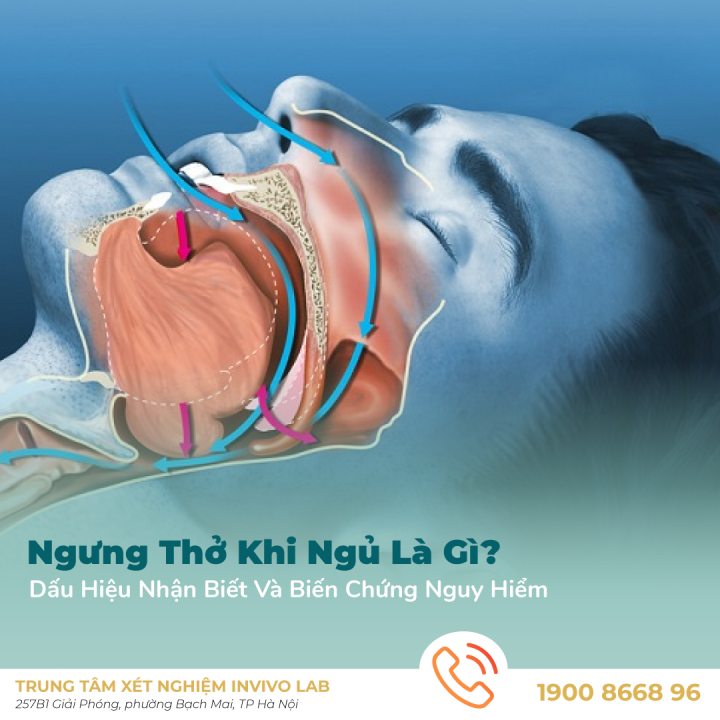 ngung-tho-khi-ngu-la-gi-dau-hieu-nhan-biet-va-bien-chung-nguy-hiem
