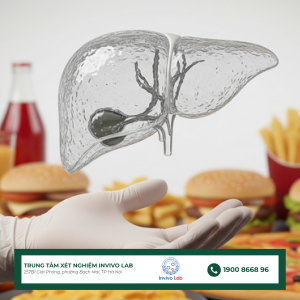 gan-nhiem-mo-khong-do-ruou-la-gi