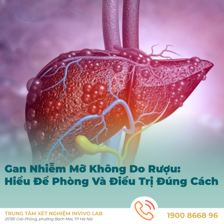 Tìm hiểu nguyên nhân, triệu chứng và cách phòng tránh gan nhiễm mỡ không do rượu để phòng tránh xơ gan và ung thư gan cùng Invivo Lab