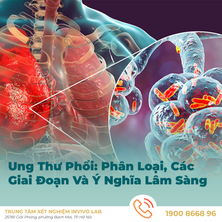 ung-thu-phoi-phan-loai-cac-giai-doan-va-y-nghia-lam-sang