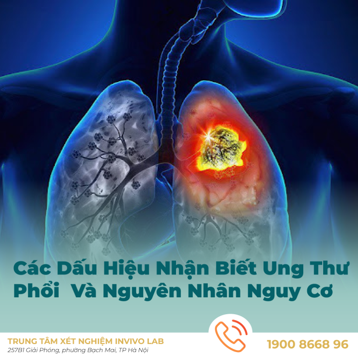 ung-thu-phoi-cac-dau-hieu-nhan-biet-va-nguyen-nhan-nguy-co