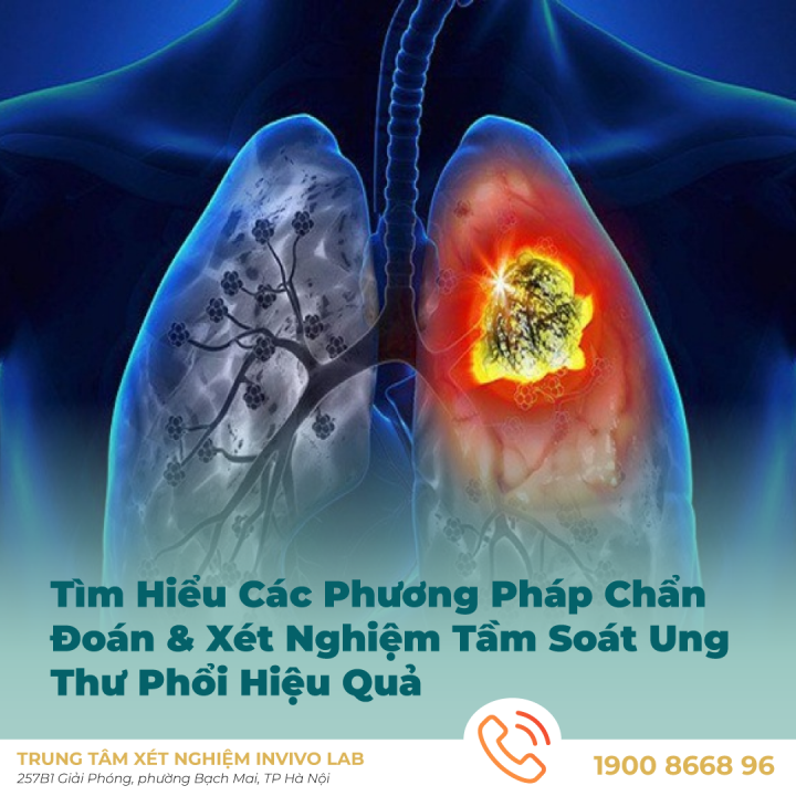 nen-chan-doan-ung-thu-phoi-som-bang-cac-phuong-phap-nao