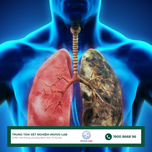 UT-phoi-nguy-hiem-nhu-the-nao