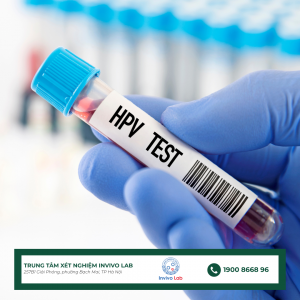 cac-luu-y-khi-di-xet-nghiem