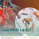 lao-phoi-la-gi-dau-hieu-nguy-co-va-cach-chan-doan-som