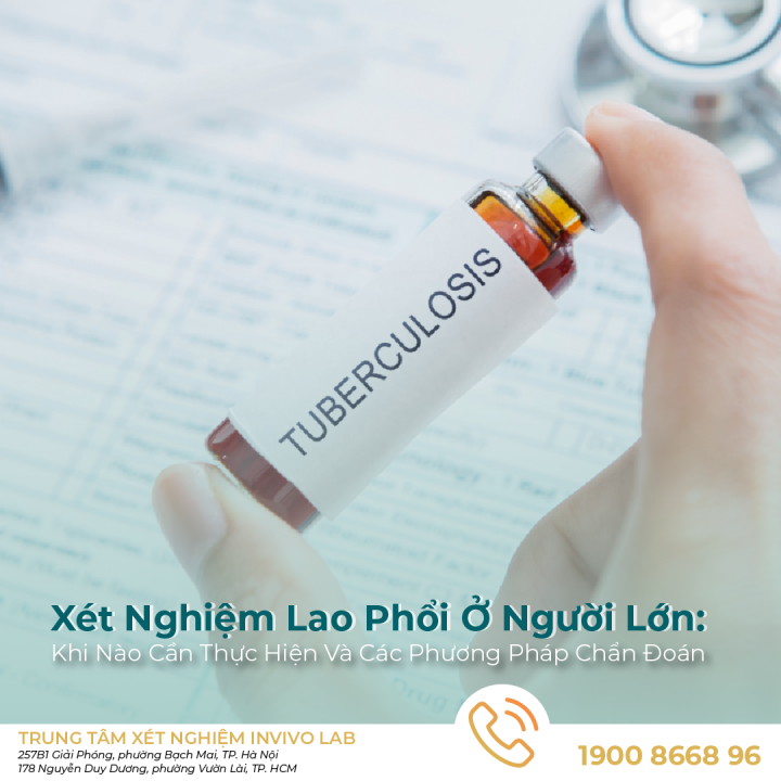 xet-nghiem-lao-phoi-khi-nao-can-thuc-hien-va-cac-phuong-phap-chan-doan