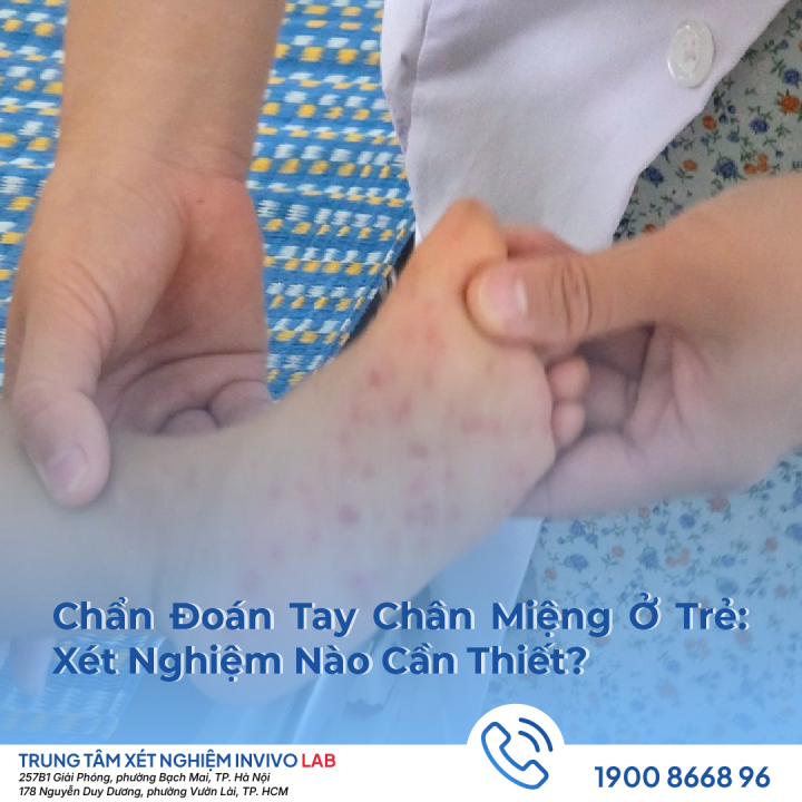 chan-doan-tay-chan-mieng-o-tre-xet-nghiem-nao-can-thiet